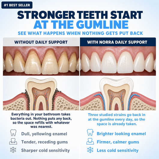 Gumline comparison: without daily support versus with Norra daily support